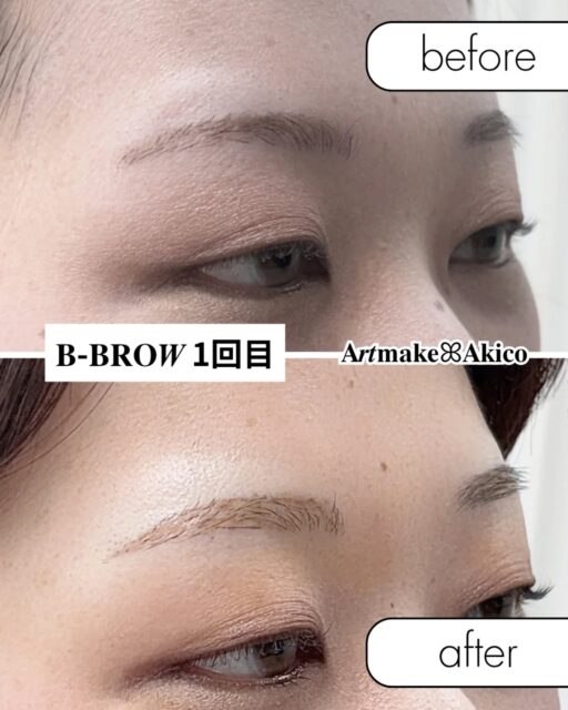 眉アートメイク𝐁-𝐁𝐑𝐎𝑾
モニター様施術事例のご紹介ですꕤ︎︎·͜·
今回は女性(1回目)のモニター様のビフォー・アフター写真と動画です♪
普段から眉毛をサロンで綺麗に整えてらっしゃる
美意識がとても高いオシャレなお客様💞
普段アーチ眉で可愛い系だったのですが、切れ長の綺麗な目や骨格を生かし、レディースストレートに変更のご提案をさせていただき、よりキリッと美しく更に美人さんになられました♪
美人さんですねーー!
ご本人様も普段のご自身から変化した
お顔全体の印象が変わり喜んでくださいました💞
また2回目も楽しみですね!
モニター様
大切なお顔をお任せくださりありがとうございました!
1回目は土台作り✨
2回目で完成✨
𝐁-𝐁𝐑𝐎𝑾は直後から自然な仕上がりに
なります♪
🫧オープニングキャンペーン🫧
🫧モニタ-募集のお知らせ🫧
今なら眉毛2回セットが
110,000円→75,000円
と通常価格より35,000円
もお🉐になっています。
それ以外のメニューもお得な料金で施術を受けられます。
✅️アートメイクに興味ある方
✅️B−BROWでアートメイクをしてみたい方
は、より詳しい内容(料金や体験者さまの感想など)をプロフのURLから詳細をチェックしてください。
ぜひぜひお待ちしてます!
また、エリア拡大の準備中です。
新宿・横浜の提携クリニックさんでの施術が可能になります。
準備整い次第、発表致しますので、よろしくお願いします。
また、武蔵野市・吉祥寺・三鷹市エリアで提携してくださるクリニックさんも探しております。
もし目に留まったクリニックの医師・開業医の諸先生方がいらっしゃいましたら、ご挨拶にお伺いさせていただきたいと思います!
小さなことからでも情報を知ってらっしゃる方がおりましたら、重ねてご連絡ください。
よろしくお願いいたします🙇♂️
𝐀𝒓𝒕𝐦𝐚𝐤𝐞ꕤ︎︎𝐀𝐤𝐢𝐜𝐨
#アートメイクモニター募集
#アートメイク
#アートメイク吉祥寺
#アートメイク三鷹
#アートメイク武蔵野市
#眉アートメイク
#bbrow
#眉毛コンプレックス
#眉毛が薄い
#眉毛に悩んでいる
#眉なし
#眉毛薄い
#すっぴん眉
#左右非対称
#眉毛が生えない
#アトピー眉毛
#すっぴんに自信がない
#時短メイク
#メイク時短