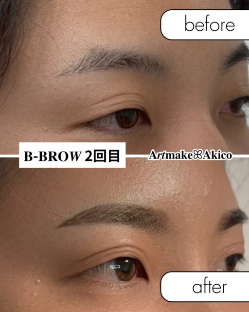 眉アートメイク𝐁-𝐁𝐑𝐎𝑾
モニター様施術事例のご紹介ですꕤ︎︎·͜·
今回は男性(2回目)のモニター様のビフォー・アフター写真です♪
施術後のインタビューは別動画で紹介いたします。
モニター様
大切なお顔をお任せくださりありがとうございました!そして、彼のご希望通りに仕上げらるように
全力でご指導してくださったアシスタントの皆様にも心から感謝です
1回目は土台作り✨
2回目で完成✨
𝐁-𝐁𝐑𝐎𝑾は直後から自然な仕上がりに
なります♪
まもなく3/31までの限定モニター価格のご予約を終了いたします
4/1からは料金改定がございますので、モニター様
受けてくださる方はDM・LINE・hpからご連絡ください♪
よろしくお願いいたします
𝐀𝒓𝒕𝐦𝐚𝐤𝐞ꕤ︎︎𝐀𝐤𝐢𝐜𝐨
🫧モニター募集のお知らせ🫧
アートメイクモニター募集のお知らせ
格安料金でアートメイクをしてみませんか?
10名様限定で3月末までモニター特別割引価格で実施してまいりましたが、皆様のご協力と温かいご支援につき、3月はご予約いっぱいとなりました🙇♀️
心より深く感謝申し上げます✨
【4月ご予約受付中】
今月末までのご予約確定で
“3月末までの価格”でご案内可能です✨
🔴残りわずか若干名です
ご希望の方はDM又はLINE・hpからご連絡ください📩
施術日に関しては、4月5日以降のご予約・ご案内になります
4月以降はオープニングキャンペーンでのご案内と共に、料金改定がございます。また日を改めてご案内させていただきますので、引き続きどうぞ宜しくお願いいたします♪
また、エリア拡大の準備中です。新宿・横浜の提携クリニックさんでの施術が可能になります。準備整い次第、発表致しますので、よろしくお願いします。
また、武蔵野市・吉祥寺・三鷹市エリアで提携してくださるクリニックさんも探しております。
もし目に留まったクリニックの医師・開業医の諸先生方がいらっしゃいましたら、ご挨拶にお伺いさせていただきたいと思います!小さなことからでも情報を知ってらっしゃる方がおりましたら、重ねてご連絡ください。
よろしくお願いいたします🙇♂️
------------------------
今なら眉毛(2回)が
110,000円→55,000円
と通常価格より55,000円
もお🉐になっています。
実施場所は、東京都内(戸越銀座)となります。
✅️アートメイクに興味ある方
✅️B−BROWでアートメイクをしてみたい方
は、より詳しい内容(料金や体験者さまの感想など)をプロフのURLから詳細をチェックしてください。
ぜひぜひお待ちしてます!
𝐀𝒓𝒕𝐦𝐚𝐤𝐞ꕤ︎︎𝐀𝐤𝐢𝐜𝐨
#男性のアートメイク
#アートメイクモニター募集
#アートメイク
#アートメイク吉祥寺
#アートメイク三鷹
#アートメイク武蔵野市
#眉アートメイク
#bbrow
#眉毛コンプレックス
#眉毛が薄い
#眉毛に悩んでいる
#眉なし
#眉毛薄い
#すっぴん眉
#左右非対称
#眉毛が生えない
#アトピー眉毛
#すっぴんに自信がない
#時短メイク
#メイク時短