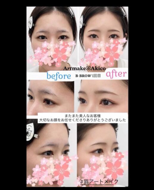 𝐀𝒓𝒕𝐦𝐚𝐤𝐞‎ꕤ︎︎𝐀𝐤𝐢𝐜𝐨‎です
いつもご覧になってくださり
ありがとうございますꕤ︎︎·͜·

お客様が皆さん美人で綺麗な方ばかりで
毎度のことですが、こちらは緊張します

今回もモデルさんのような美人さんがきてくださいましたm(__)m

アレルギー体質の方のアートメイク対応で
ご提供させていただきました🫧

1回目は右眉だけ強く麻酔腫れがあったりと
難航もありましたが、なんとか終えて
土台作りから仕上げていきました

とってもとっても美人なHさん🌸
大切なお顔をお任せくださりありがとうございました♪

　　　　　　
　　　　　　𝐀𝒓𝒕𝐦𝐚𝐤𝐞‎ꕤ︎︎𝐀𝐤𝐢𝐜𝐨‎

#アートメイクモニター募集
#眉アートメイク
#アートメイクキャンペーン 
#アートメイク新宿 
#bbrow
眉毛コンプレックス
眉毛が薄い
眉毛に悩んでいる
眉なし
眉毛薄い
すっぴん眉
左右非対称
眉毛が生えない
アトピー眉毛
すっぴんに自信がない
時短メイク
メイク時短