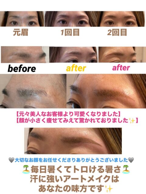 いつもご覧になってくださり
ありがとうございます❁⃘*.゚
𝐀𝒓𝒕𝐦𝐚𝐤𝐞ꕤ︎︎𝐀𝐤𝐢𝐜𝐨ですꕤ︎︎·͜·
急に毎日暑くなりましたね🏝️
〜〜汗で眉毛とれてませんか?〜〜
〜〜皆さんの目元は無事ですか?〜〜
トロける🫠暑さで眉も目元もメイクか崩れて
困ったなーって思うことが多々あるのではないでしょうか🫧
【汗にも水にも無敵で強いアートメイク🫧】
で夏も大汗かいて元気いっぱい過ごしませんか?🩵
とっても可愛くなったお客様
汗をかくお仕事で眉毛がとれちゃうお悩みが
あったそうですが、これで夏もお仕事も心配解消です
大切なお顔をお任せくださりありがとうございました🏝️🌻🌺🏖️🛟🏊🌊🍉
𝐀𝒓𝒕𝐦𝐚𝐤𝐞ꕤ︎︎𝐀𝐤𝐢𝐜𝐨
自分らしく自然に生きやすい毎日が心地いい♡
#40代50代60代70代こそアートメイクです!
#アイラインモニター募集
#眉アートメイク
#アイラインアートメイク
#吉祥寺お住いの方へ🎶ぜひご連絡ください
提携クリニックは新宿恵比寿横浜です
bbrow
眉毛コンプレックス
眉毛が薄い
眉毛に悩んでいる
眉なし
眉毛薄い
すっぴん眉
左右非対称
眉毛が生えない
軽度のアトピーもちの方
すっぴんに自信がない方
時短メイクしたいママさん
メイク時短目指したい方40