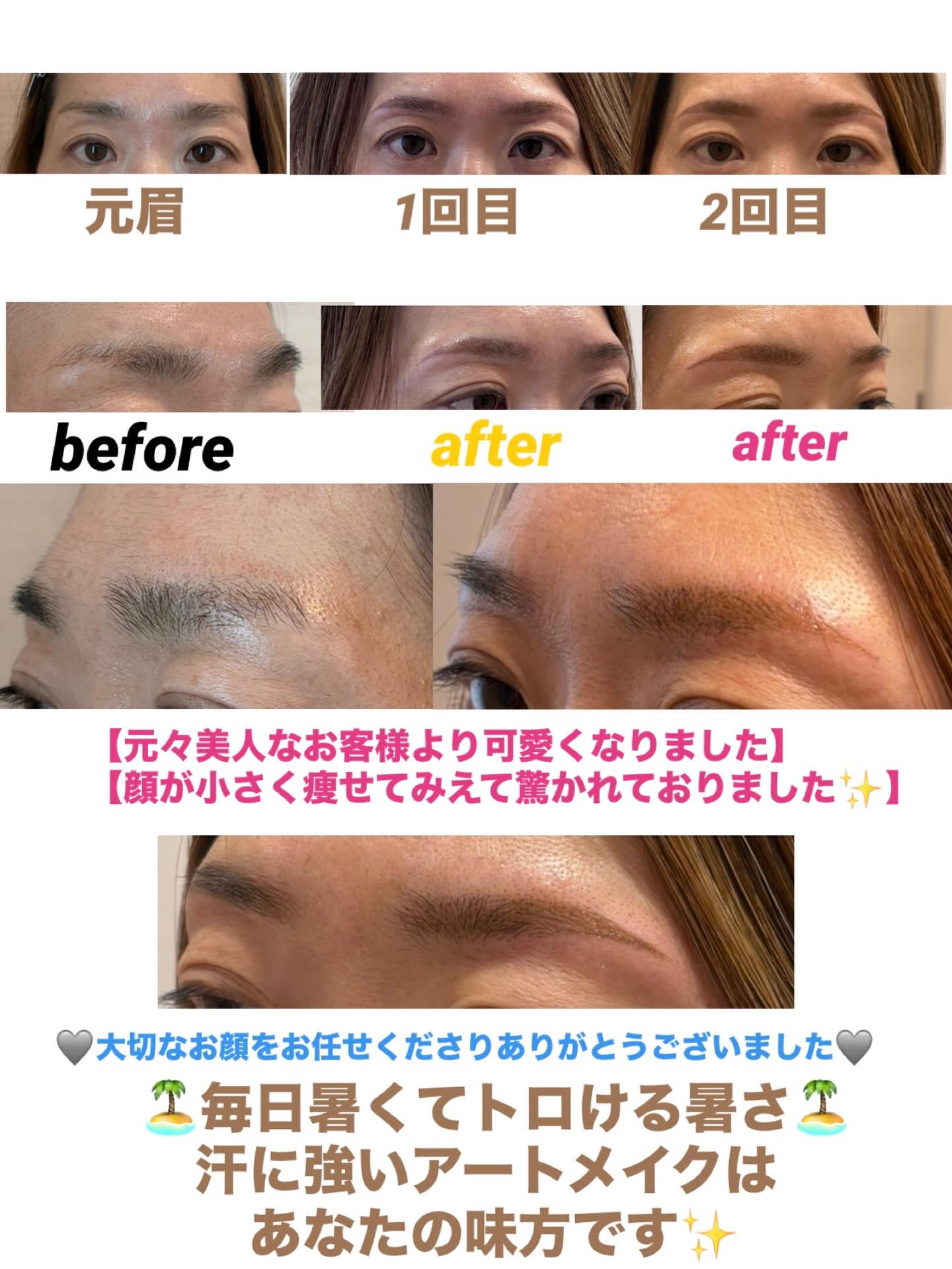 いつもご覧になってくださり
ありがとうございます❁⃘*.゚
𝐀𝒓𝒕𝐦𝐚𝐤𝐞ꕤ︎︎𝐀𝐤𝐢𝐜𝐨ですꕤ︎︎·͜·
急に毎日暑くなりましたね🏝️
〜〜汗で眉毛とれてませんか?〜〜
〜〜皆さんの目元は無事ですか?〜〜
トロける🫠暑さで眉も目元もメイクか崩れて
困ったなーって思うことが多々あるのではないでしょうか🫧
【汗にも水にも無敵で強いアートメイク🫧】
で夏も大汗かいて元気いっぱい過ごしませんか?🩵
とっても可愛くなったお客様
汗をかくお仕事で眉毛がとれちゃうお悩みが
あったそうですが、これで夏もお仕事も心配解消です
大切なお顔をお任せくださりありがとうございました🏝️🌻🌺🏖️🛟🏊🌊🍉
𝐀𝒓𝒕𝐦𝐚𝐤𝐞ꕤ︎︎𝐀𝐤𝐢𝐜𝐨
自分らしく自然に生きやすい毎日が心地いい♡
#40代50代60代70代こそアートメイクです!
#アイラインモニター募集
#眉アートメイク
#アイラインアートメイク
#吉祥寺お住いの方へ🎶ぜひご連絡ください
提携クリニックは新宿恵比寿横浜です
bbrow
眉毛コンプレックス
眉毛が薄い
眉毛に悩んでいる
眉なし
眉毛薄い
すっぴん眉
左右非対称
眉毛が生えない
軽度のアトピーもちの方
すっぴんに自信がない方
時短メイクしたいママさん
メイク時短目指したい方40